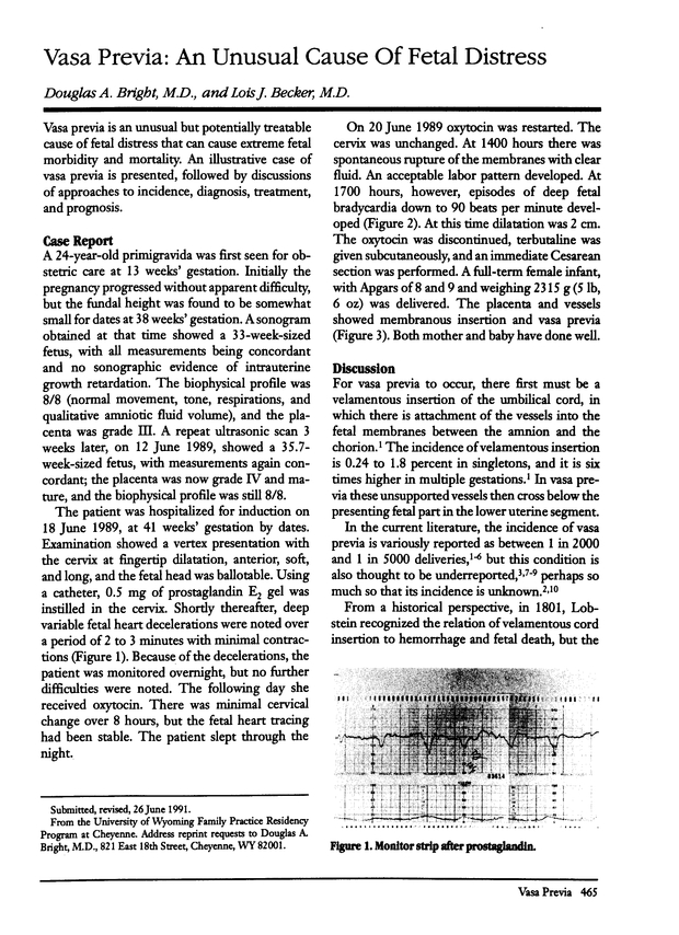 PDF extract preview