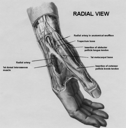 Figure 1a.