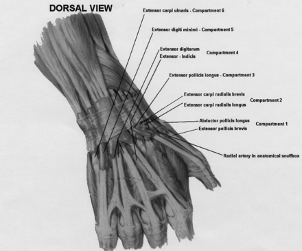 Figure 1a.