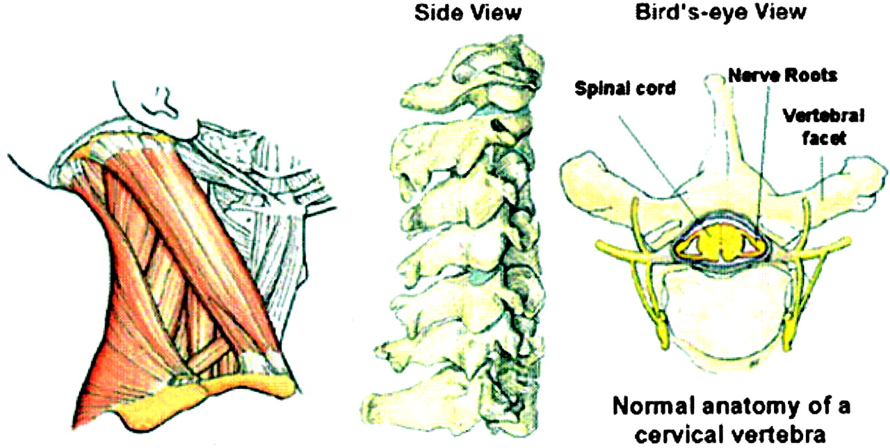 Evaluation and Treatment of Posterior Neck Pain in Family Practice