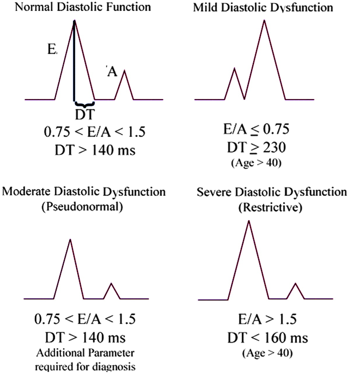 Diastolic dysfunction