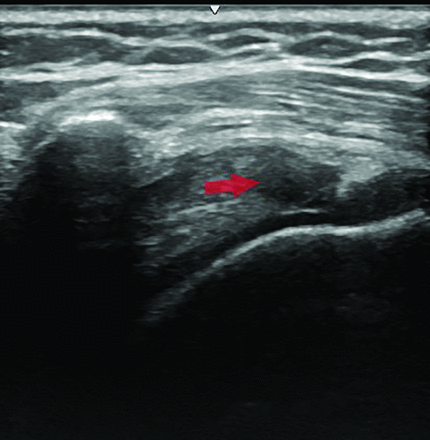 Figure 6.