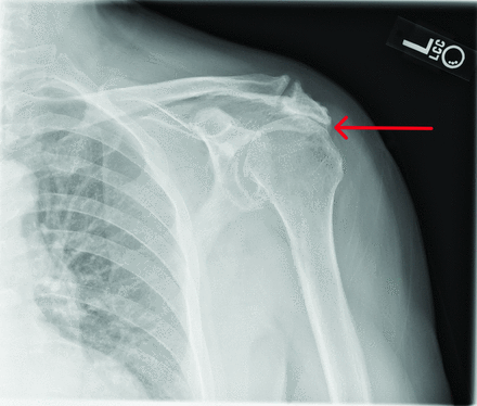 Figure 9.